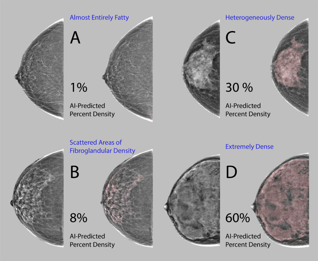 PDF) What is a large breast? Measuring and categorizing breast